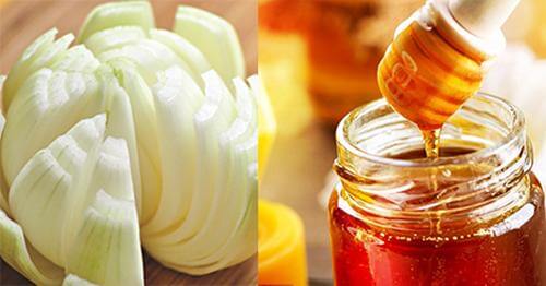 Loạt công dụng làm đẹp đầy bất ngờ của hành chị em cần bỏ túi ngay! 1 7