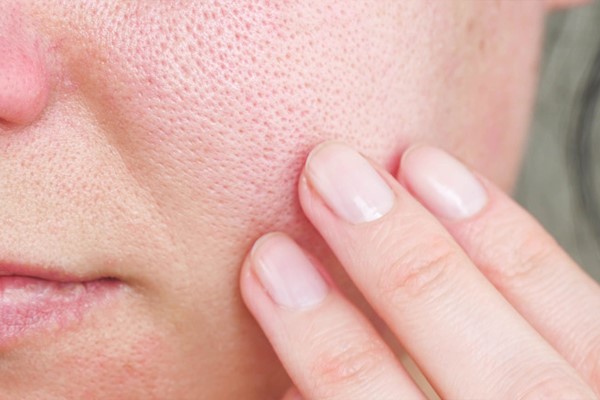 Tác hại của Retinol trên da nếu dùng sai liều lượng hoặc không đúng cách